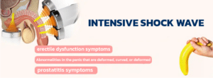 Erectile Dysfunction Shock Wave Therapy for Erectile Dysfunction (EDSWT For ED)