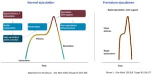 what-is-premature ejaculation - ETERNITY CLINIC by M.D. SUEBPONG ENGCHUAN what-is-premature ejaculation