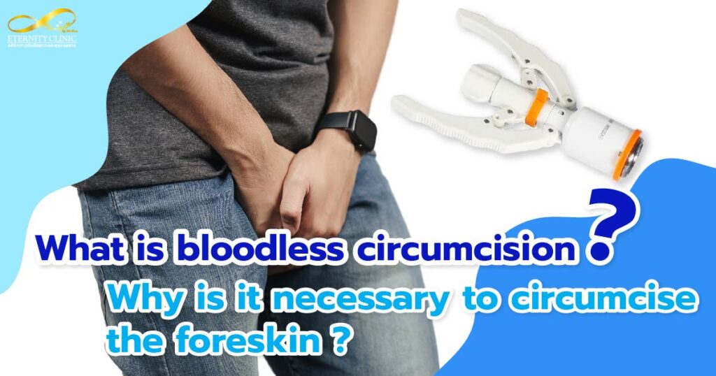 bloodless circumcision - ETERNITY CLINIC by M.D. SUEBPONG ENGCHUAN bloodless circumcision