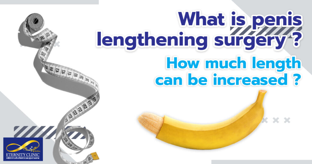 penis lenghthening - ETERNITY CLINIC by M.D. SUEBPONG ENGCHUAN penis lengthening. How much length can be increased?