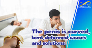 The penis is curved, bent, deformed