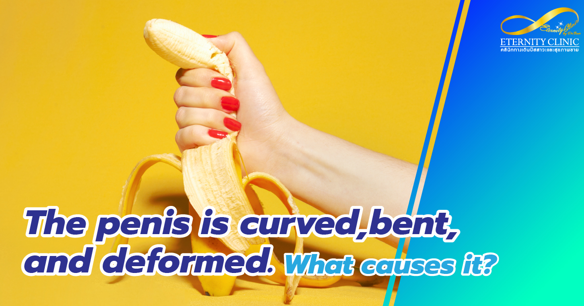 The penis is curved, bent, deformed - ETERNITY CLINIC by M.D. SUEBPONG ENGCHUAN The penis is curved, bent, deformed