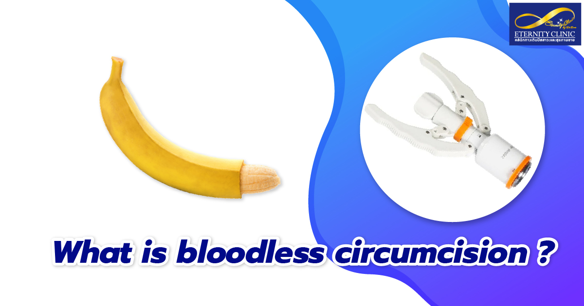 bloodless circumcision - ETERNITY CLINIC by M.D. SUEBPONG ENGCHUAN bloodless circumcision