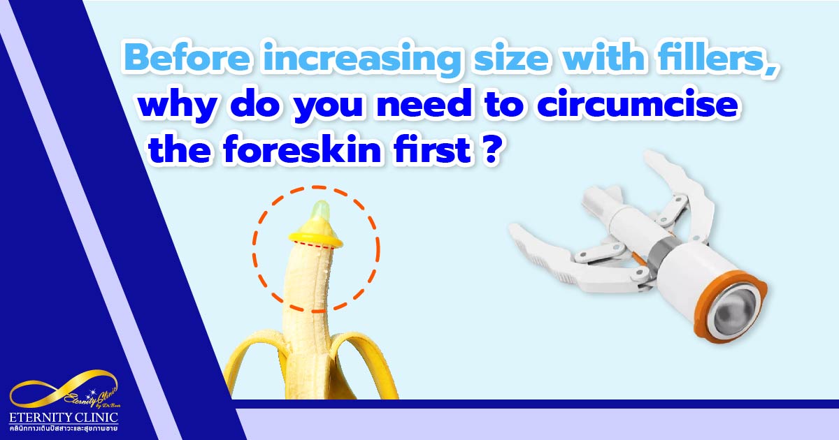 circumcision first - ETERNITY CLINIC by M.D. SUEBPONG ENGCHUAN before use fillers, why you need to do circumcision first?