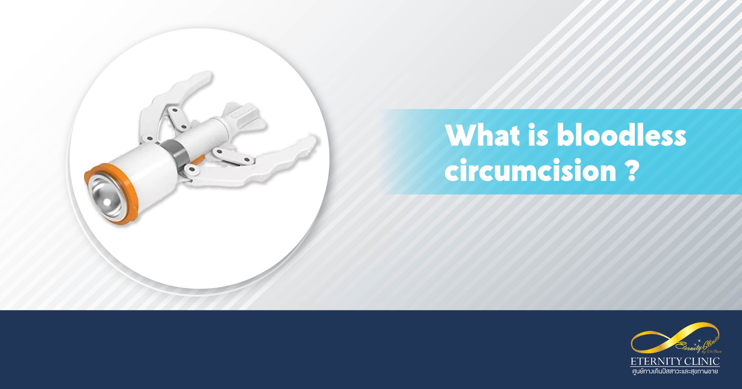 What is bloodless circumcision