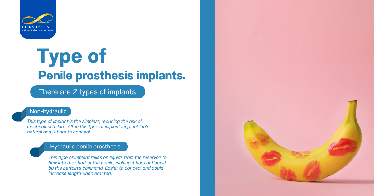 ประเภทของ - ETERNITY CLINIC by M.D. SUEBPONG ENGCHUAN Type of Penile prosthesis implants.