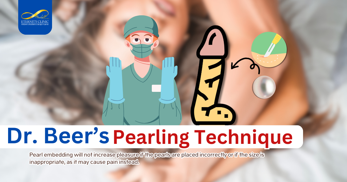 Beer’s3 - ETERNITY CLINIC by M.D. SUEBPONG ENGCHUAN Dr.Beer Pearling Technique stlye