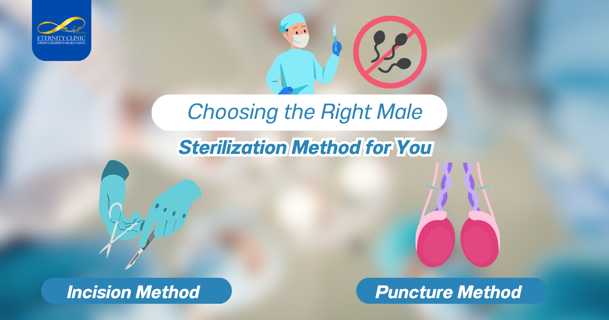 Choosing the - ETERNITY CLINIC by M.D. SUEBPONG ENGCHUAN Choosing the Right Male Sterilization (Vasectomy) Method for You