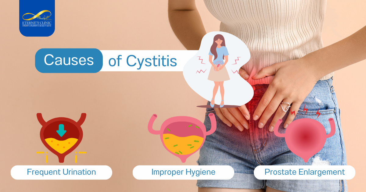 Symptoms3 - ETERNITY CLINIC by M.D. SUEBPONG ENGCHUAN Causes of Cystitis. Frequent Urination, Improper Hygiene, Prostate Enlargement.