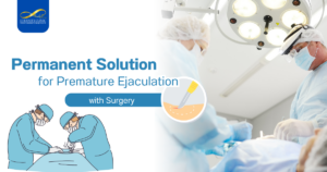 Premature Ejaculation