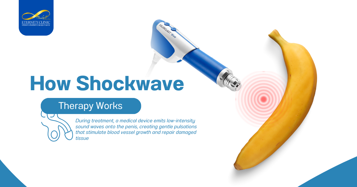 Shockwave3 - ETERNITY CLINIC by M.D. SUEBPONG ENGCHUAN How Shockwave Therapy Works