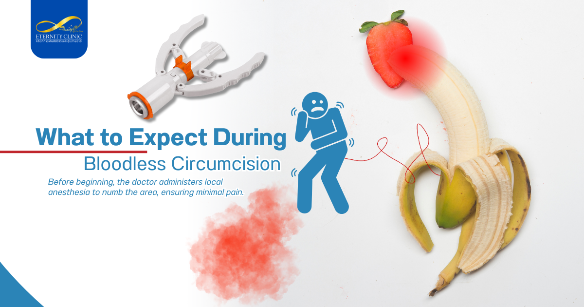 Bloodless Circumcision3 - ETERNITY CLINIC by M.D. SUEBPONG ENGCHUAN Circumcision