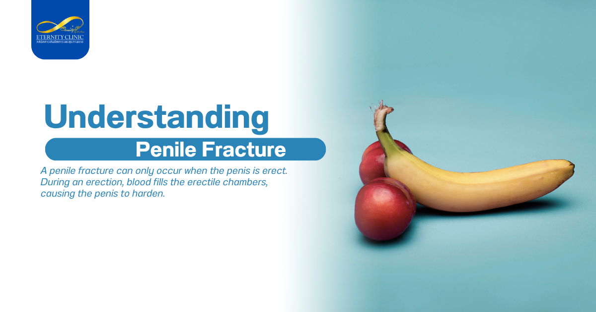 Understanding Penile Fracture