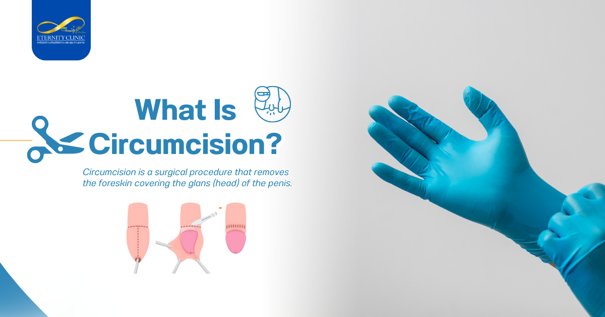 What Is Circumcision?
