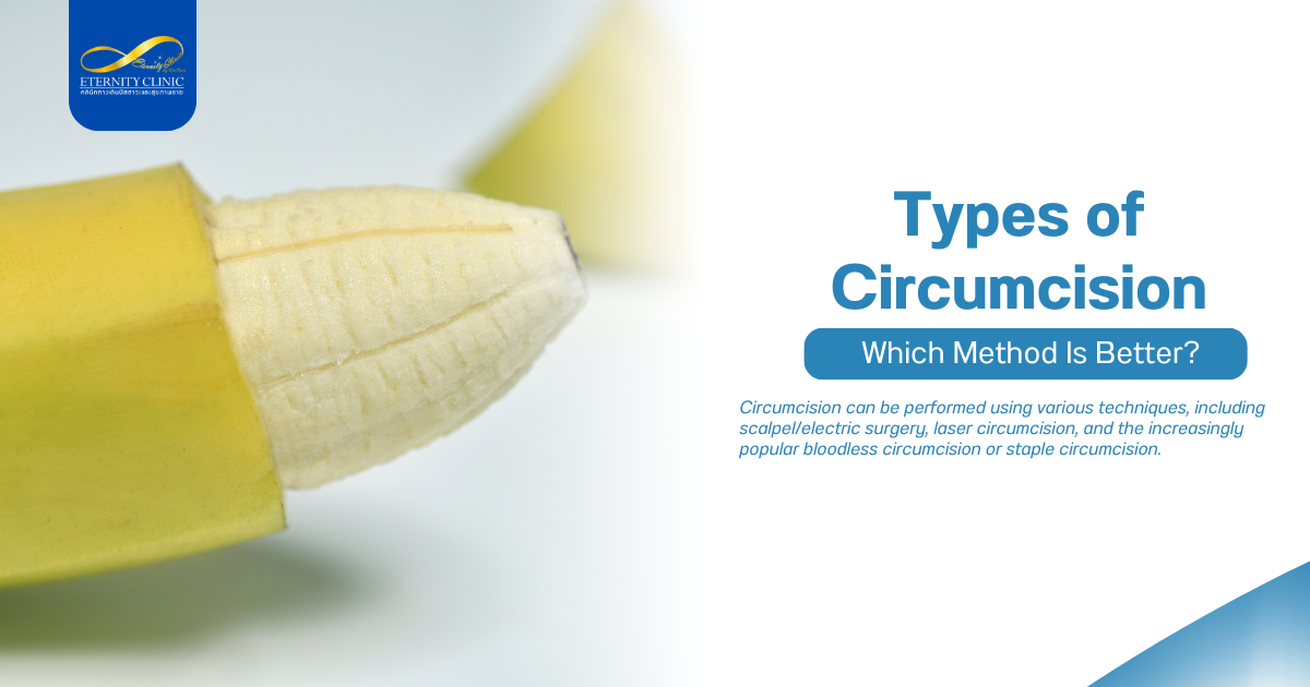 Being Circumcised4 - ETERNITY CLINIC by M.D. SUEBPONG ENGCHUAN Types of Circumcision