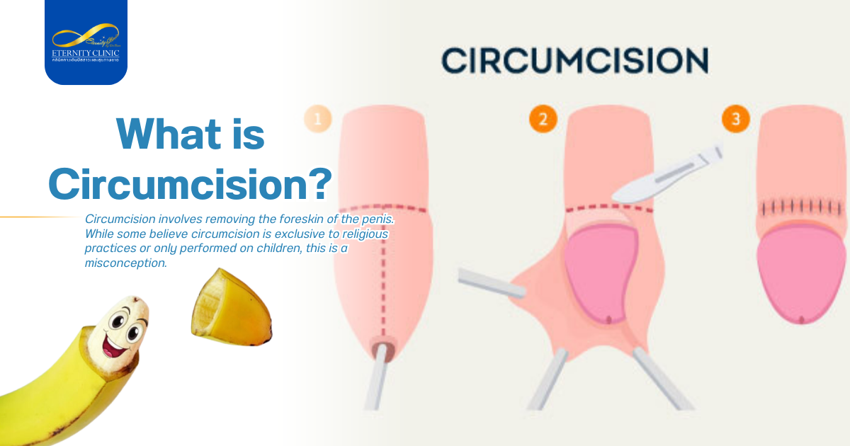 Dr. Beer3 - ETERNITY CLINIC by M.D. SUEBPONG ENGCHUAN What is Circumcision?
