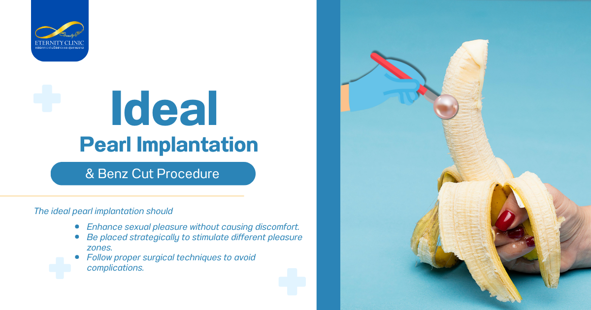 การฝังไข่มุก - ETERNITY CLINIC by M.D. SUEBPONG ENGCHUAN Pearl Implantation