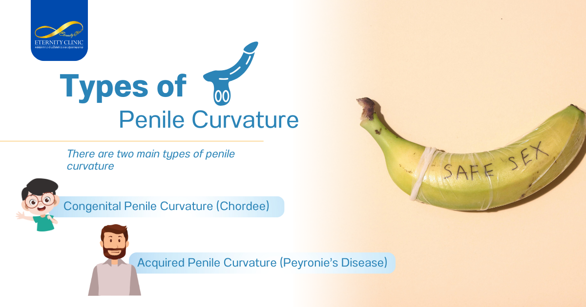 ประเภทของความโค้งขององคชาต - ETERNITY CLINIC by M.D. SUEBPONG ENGCHUAN Types of Penile Curvature