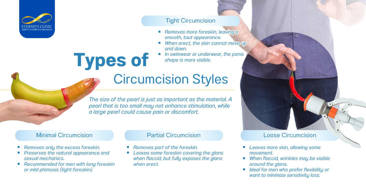 รูปแบบการขลิบ - ETERNITY CLINIC by M.D. SUEBPONG ENGCHUAN Types of Circumcision Styles