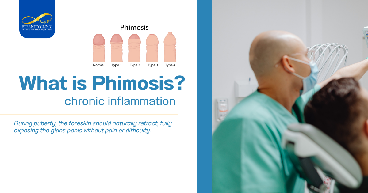 อาการอักเสบเรื้อรัง - ETERNITY CLINIC by M.D. SUEBPONG ENGCHUAN What is Phimosis?
