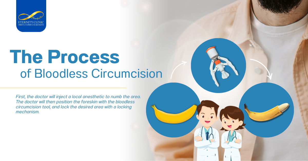 กระบวนการขลิบหนังหุ้มปลาย - ETERNITY CLINIC by M.D. SUEBPONG ENGCHUAN The Process of Bloodless Circumcision