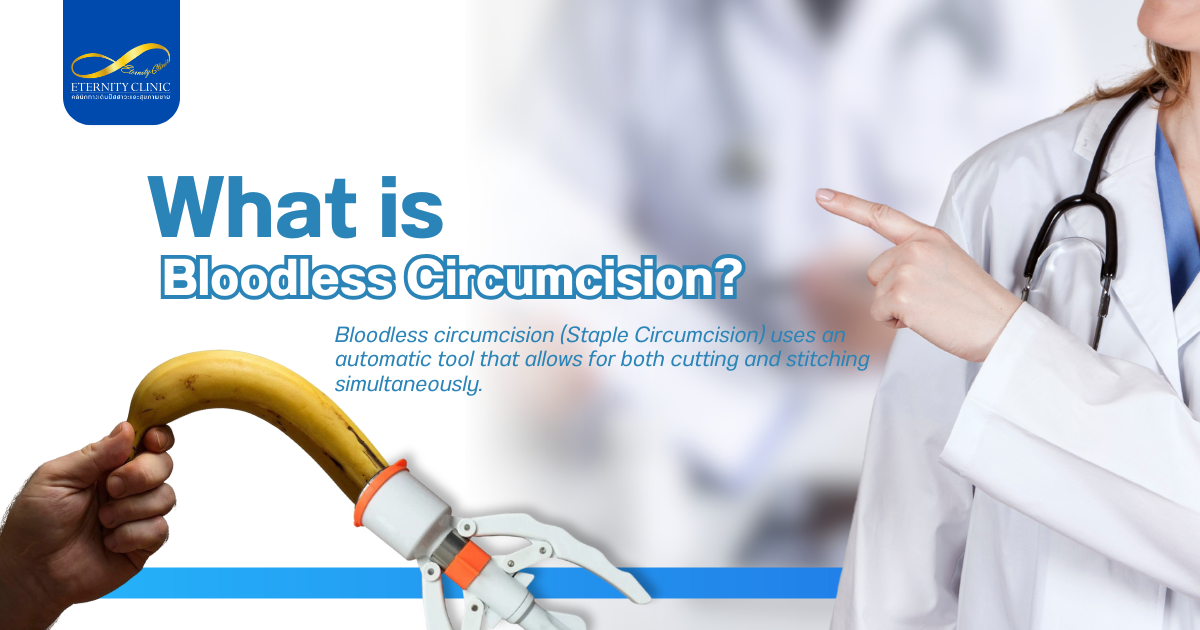 การขลิบหนังหุ้มปลาย - ETERNITY CLINIC by M.D. SUEBPONG ENGCHUAN Bloodless Circumcision