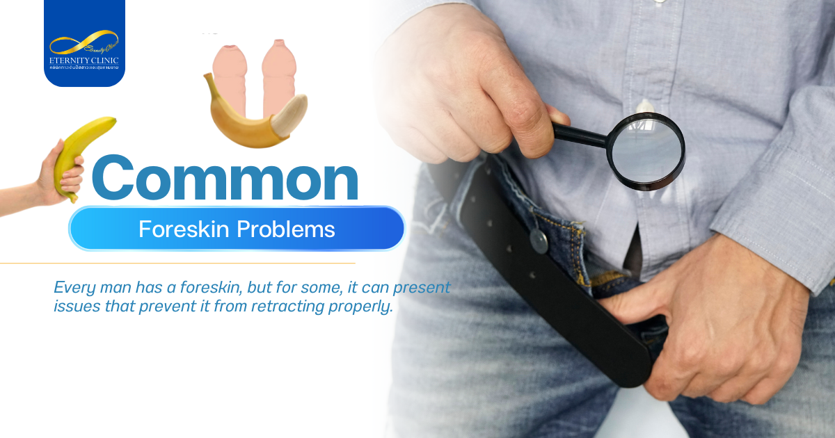 ปัญหาหนังหุ้มปลายทั่วไป - ETERNITY CLINIC by M.D. SUEBPONG ENGCHUAN Foreskin Problems