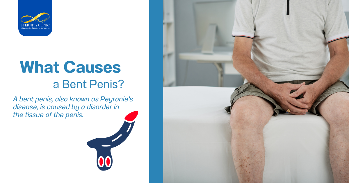 อะไรทำให้องคชาตคด - ETERNITY CLINIC by M.D. SUEBPONG ENGCHUAN What Causes a Bent Penis